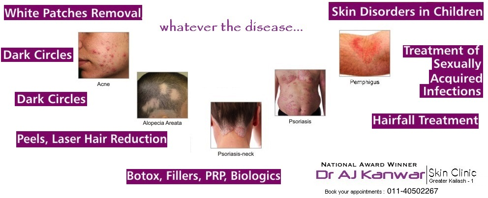 National Award Winner ~ Dr . Roy Award Winner ~ Awarded by President of  India ~ Best Dermatologist in Greater Kailash Noida Gurgaon Search For Skin  Specialists | Acne, Pemphigus, Vitiligo, Psoriasis,